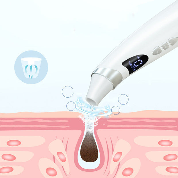 Electric Blackhead Suction Instrument for Pore Perfection and Glowing Skin!"