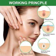 Invisible Acne Patch - To Clean Acne And Eliminate Acne