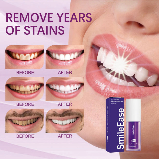 Smile Ease Purple Toothpaste: Colour Corrector for Brightening Your Smile!