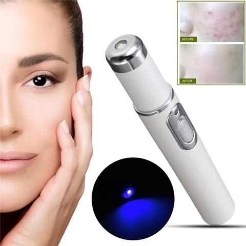 Blue Light Beauty Mastery for Acne and Wrinkle Removal!"